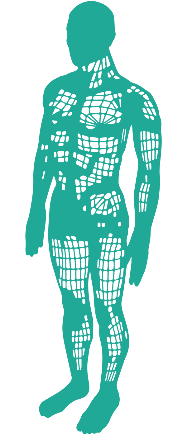 AOP_4